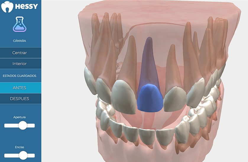Odontograma 3D de Hessy Dental